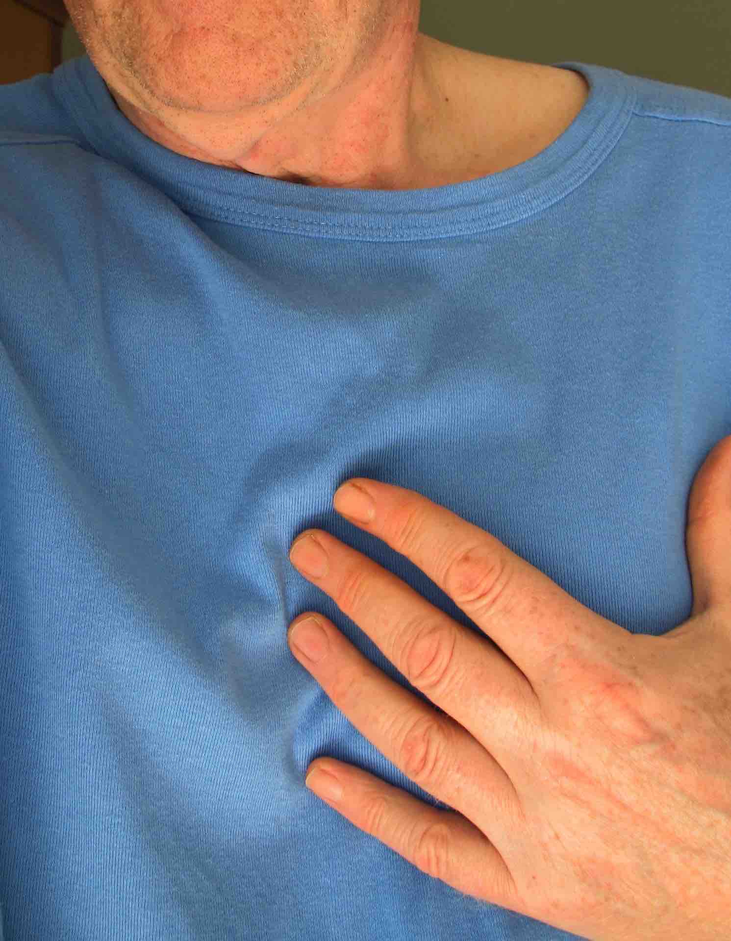Many people stop taking life-saving drugs after heart attacks